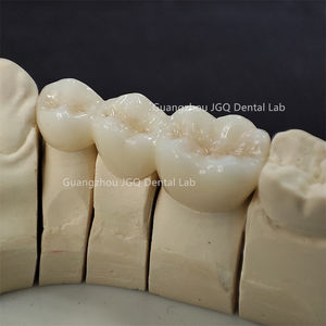 Prothèse dentaire de laboratoire dentaire Couronnes et ponts en zircone Livraison rapide et à bas prix - Product Image 5