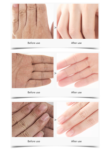 Omylady masker tangan pelembap, masker pengelupasan pemutih hydirosis untuk perawatan Jet Peel - Product Image 6