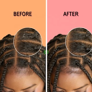 Custom Package No Rinse for Locs Twists Weaves Invigorate <strong>s</strong> Braid <strong>Shampoo</strong> - Product Image 6