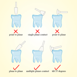 Outils de polissage dentaire en silicone de haute qualité FG/RA, polisseurs en silicone pour le polissage des <span class=keywords><strong>prothèses</strong></span> en céramique et en alliage - Product Image 4