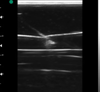 Modèle de ponction veineuse centrale guidée par ultrasons pour l'enseignement en sciences médicales, modèle de ponction de la veine jugulaire et de la veine sous-claviculaire