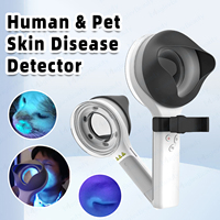 Lámpara de Wood para Dermatología, Luz Ultravioleta para Examen de Vitiligo, Psoriasis y Eccema, Dermatoscopio, Analizador de Piel