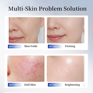 Crema Viso Diretta dalla Fabbrica con 1% Peptidi di Rame e Acido Ialuronico, Anti-Età, Idratante, GHK-Cu, Effetto Lifting, per Tutti i Tipi di Pelle - Product Image 4
