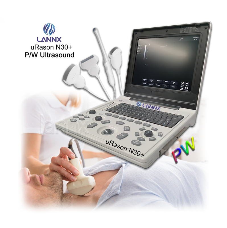 LANNX URason N30 Medical Equipment Black