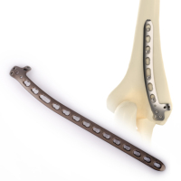 Plaque de fixation humérale CANWELL 02 en titane, distale latérale dorsale, anatomique, pour chirurgie orthopédique traumatique et fractures, certifiée CE, OEM, Classe A