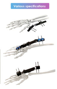 Profesional Of-<span class=keywords><strong>Distal</strong></span> <span class=keywords><strong>Radius</strong></span> Fixator B pergelangan tangan sendi ortopedi tulang eksternal Fixator - Product Image 6