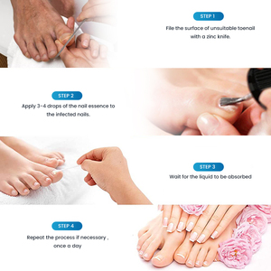 Produits Sumifun Soins de santé pour les pieds avec vitamine E, capacité de 15 ml - Product Image 6