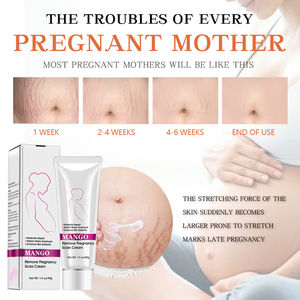 Prix de gros meilleur <span class=keywords><strong>2022</strong></span> MANGO marque privée <span class=keywords><strong>crème</strong></span> anti-vergetures <span class=keywords><strong>crème</strong></span> efficace <span class=keywords><strong>pour</strong></span> les vergetures - Product Image 4