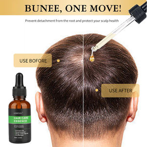 Huile capillaire antipelliculaire biologique CKTUING 30ML avec gingembre, acide hyaluronique et huile d'arbre à thé pour la repousse naturelle des cheveux - Product Image 2