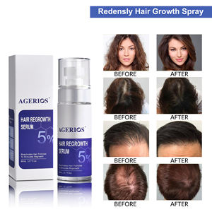 <span class=keywords><strong>Spray</strong></span> para el Crecimiento del Cabello Redensyl, <span class=keywords><strong>Bloqueador</strong></span> de DHT a Base de Plantas para Hombres y Mujeres, Suero Anticaída para Estimular los Folículos - Product Image 5