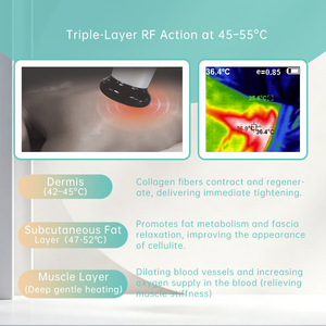 Leaflife เครื่องนวดแข<span class=keywords><strong>น</strong></span>หุ่นยนต์ลูกกลิ้ง<span class=keywords><strong>น</strong></span>วดร่างกายอัตโนมัติเครื่องมือ<span class=keywords><strong>น</strong></span>วดไฟฟ้าสำหรับกล้ามเนื้อเทคโนโลยี - Product Image 5