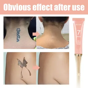 Crème de suppression de tatouages en gros <span class=keywords><strong>pour</strong></span> usine, crème corporelle à ingrédients doux, sans dommage <span class=keywords><strong>pour</strong></span> la peau - Product Image 6