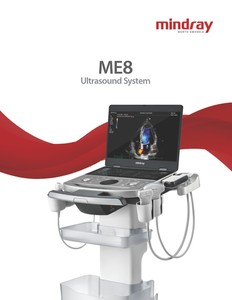 เครื่องอัลตราซาวนด์สีดิจิตอลแบบพกพา Mindray ME8 ME Series สำหรับสัตวแพทย์ พร้อมฟังก์ชันการทำงานที่เสถียร - Product Image 6