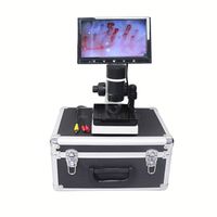 Hi-Tech Optical Instrument Blood test Electron Microscope Machine Blood Vessel Microscope Blood Microcirculation Test Analyzer