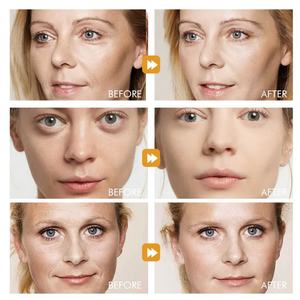 Whitening Facial Skin <b>Care</b> Anti Aging Brighten Brightening Hyaluronic Acid Face Vitamin C Serum - Product Image 5