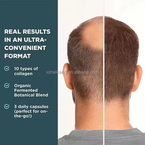 개인 상표 공장 콜라겐 복잡한 viviscal 남자의 머리 규정 식 보충 교재 180 정제 영양 머리 보충 정제 - Product Image 5