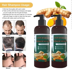 Après-shampoing anti-chute au gingembre <span class=keywords><strong>pour</strong></span> la croissance des cheveux, marque privée, à base de plantes naturelles, <span class=keywords><strong>pour</strong></span> une croissance rapide des cheveux - Product Image 2