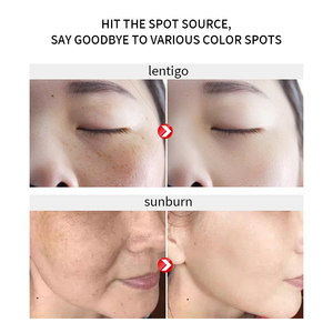 Crème éclaircissante pour le visage à l'arbutine, crème hydratante éclaircissante <span class=keywords><strong>rapide</strong></span> en <span class=keywords><strong>7</strong></span> <span class=keywords><strong>jours</strong></span> pour tous types de peaux, OEM/ODM personnalisé - Product Image 5