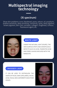 2025 analyse d'analyseur de peau de tendance faisant face à des problèmes de peau détectent des rides - Product Image 3