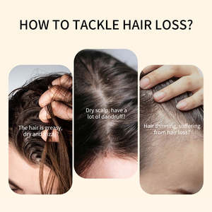 แชมพูและครีมนวดผมสูตรสมุนไพรโรสแมรี่ไบโอติน สำหรับผมชี้ฟู ช่วยเร่งการเจริญเติบโตของเส้นผม  ไม่มีพาราเบน ไม่มีซัลเฟต สำหรับร้านเสริมสวย  ผสมสารสกัดจากหัวหอมแดง - Product Image 3