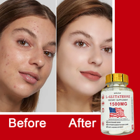 Capsules de L-Glutathion à Marque Privée Personnalisée 1500mg avec Collagène Vitamine C Blanchiment de la Peau pour Adultes Antioxydant Soutien du Foie