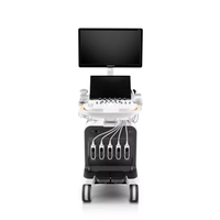 Ecógrafo Doppler Color 3D 4D SonoScape P80 ELITE de Alta Calidad con Software Profesional de IA para Hospitales y Clínicas