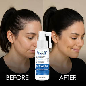 Best-seller - Huile capillaire réparatrice pour cheveux secs et abîmés, 100% pure et biologique, enrichie en caféine, favorisant la croissance des cheveux - Product Image 6