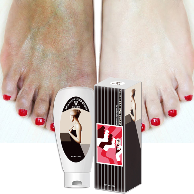 Собственная торговая марка, оптовая продажа, эффективный отбеливающий крем для лица, шеи и тела, крем против отбеливания