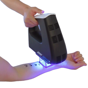 Lámpara de Fototerapia UVB de 308nm, Láser Excimer para el Tratamiento de Vitiligo y Psoriasis, <span class=keywords><strong>Crema</strong></span>, Máquina de Terapia de Luz UV - Product Image 5