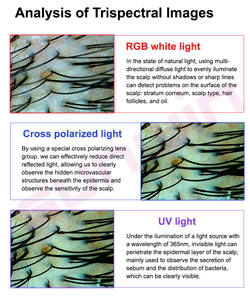 Analisador de Crescimento Capilar e Couro Cabeludo com IA de 16MP e Zoom Óptico de 10X-200X para Monitoramento Preciso da Queda de Cabelo e Saúde dos Folículos - Product Image 6