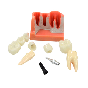 Modèle d'<span class=keywords><strong>implant</strong></span> <span class=keywords><strong>dentaire</strong></span> pour la démonstration patiente Modèle de <span class=keywords><strong>couronne</strong></span> et de pont d'<span class=keywords><strong>implant</strong></span> <span class=keywords><strong>dentaire</strong></span> - Product Image 2