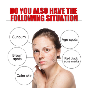 Eelhoe 30pcs mặt tối tại chỗ Corrector làm trắng cháy nắng bướm Rạng rỡ mang thai đốm mụn đánh dấu tàn nhang loại bỏ chất lỏng - Product Image 5