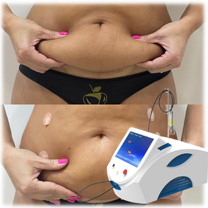 Endolaser Estiramiento <span class=keywords><strong>DE</strong></span> LA PIEL Lipólisis Liposucción 980nm 1470nm Estiramiento facial Máquina <span class=keywords><strong>de</strong></span> cánulas <span class=keywords><strong>de</strong></span> fibra Fibra óptica Estiramiento <span class=keywords><strong>DE</strong></span> LA PIEL Apretar - Product Image 1