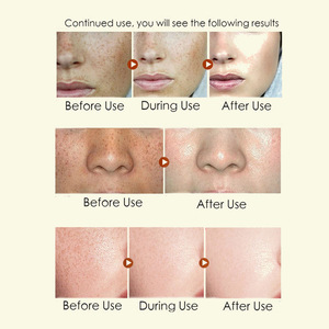 Ácido Hialurónico al 5% al por Mayor para Crema Facial con Colágeno y Glicerina, Humectante Diurno, Blanqueador, Antienvejecimiento, Etiqueta Privada OEM - Product Image 5
