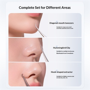 Ensemble de pinces à épiler professionnelles en acier inoxydable pour éliminer les points noirs, extracteur d'acné de précision, élimination des comédons pour le nettoyage des pores du visage - Product Image 3