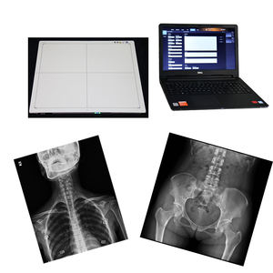 Radiografía digital 17*17 Detector de panel plano de rayos X inalámbrico digital para sistema <span class=keywords><strong>DR</strong></span> - Product Image 2
