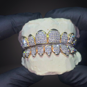 Grillz dentaire KIVORA en argent 925, serti de moissanite taille brillant rond, style hip-hop, unisexe, pour usage quotidien - Product Image 4
