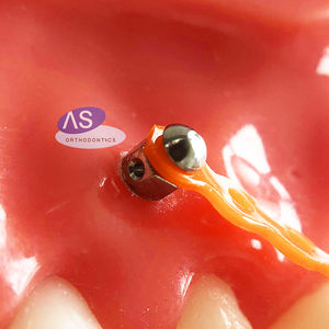 Ortodontico Micro Tornillos cacciavite e accessori per lame impianto dentale endosseo - Product Image 3