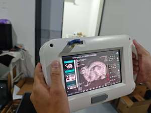 Draagbare röntgenapparaat, eenvoudig draagbaar röntgenapparaat, draagbare röntgenscanner, lichtgewicht en draagbaar, compact ontwerp - Product Image 6