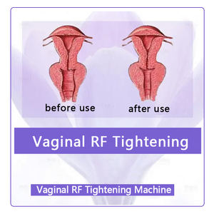 Vajinal sıkma kapsül gençleştirme vajinal sıkma makinesi makinesi vajinit pelvik kat eğitmen - Product Image 3