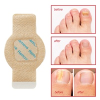 Patchs correcteurs antifongiques à base de plantes chinoises pour le traitement des ongles incarnés et le soin anti-infectieux