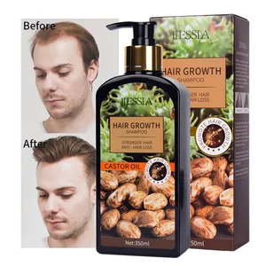 Castor Oil Shampoo Anti Hair Loss