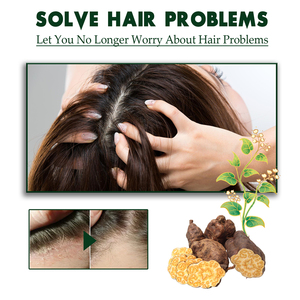 Shampoo anti-démangeaisons South Moon Tinea Capitis pour la dermatite séborrhéique, le <span class=keywords><strong>psoriasis</strong></span>, soulagement des démangeaisons et élimination des pellicules - Product Image 5