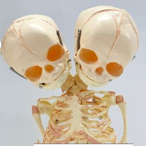 Modèle de squelette humain de bébé, squelette fœtal à deux têtes, déformité du squelette du nourrisson, décoration d'Halloween - Product Image 4