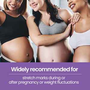 Lotion corporelle hydratante nourrissante naturelle végane à étiquette privée pour soulager les démangeaisons, éclaircir la peau et éliminer les vergetures pour les femmes enceintes - Product Image 5