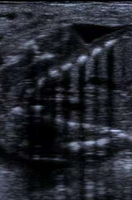 Appareil de surveillance vétérinaire portable, appareil d'échographie pour la diagnostic de la gestation animale