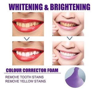 Dentifrice blanchissant couleur, usage orthodontique, fluorure, anti-taches jaunes, plaque <span class=keywords><strong>dentaire</strong></span>, éclaircissement des dents, haleine fraîche 24h, anti-caries - Product Image 6