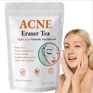 Sachets de thé détox anti-acné à la rose et au chèvrefeuille 100g (20 sachets) pour le traitement de l'acné - Product Image 1