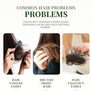 Set de Cuidado Capilar Herbal Anticaspa GreenLem Usman Grass, Champú para Cabello Natural, Set de Cuidado del Cuero Cabelludo para Cabello Dañado - Product Image 4