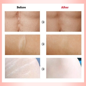 Tratamiento de crema Stretchmark Free para eliminar cicatrices naturales de alta eficacia - Product Image 6